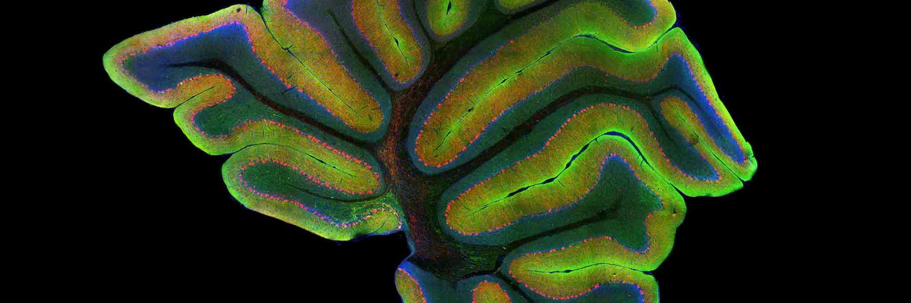 Laser scanning confocal image of a mouse cerebellum. Credit: Gabriel Luna