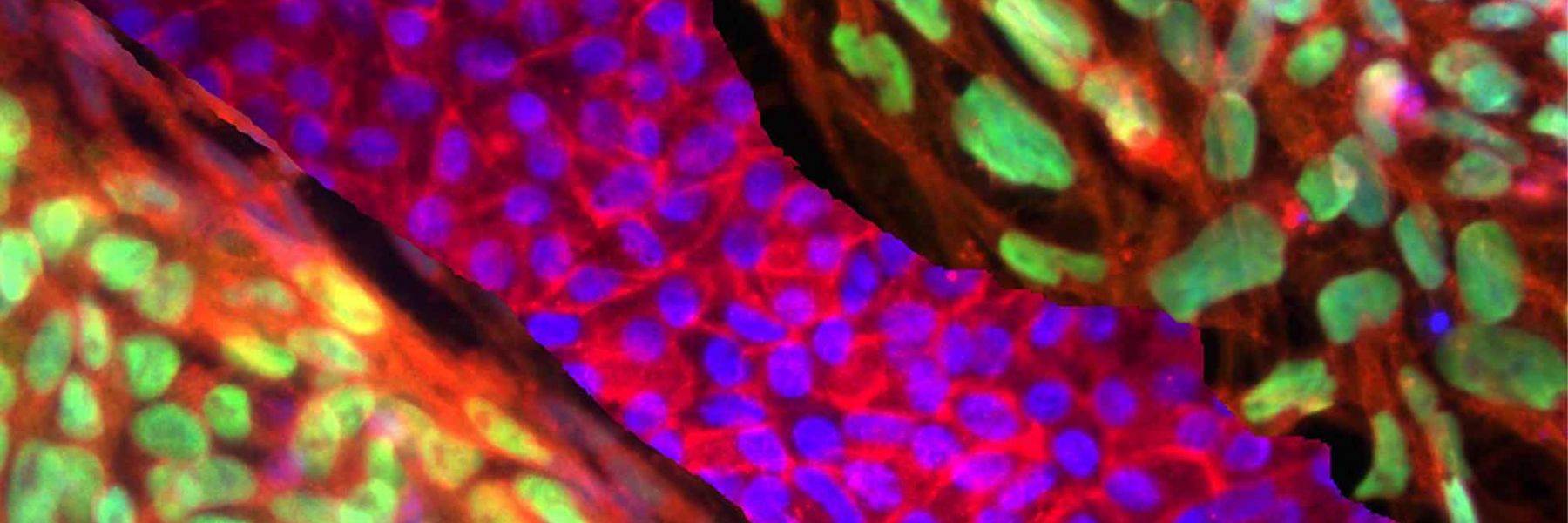 Stem cells. Credit: Teisha Rowland & Clegg Lab